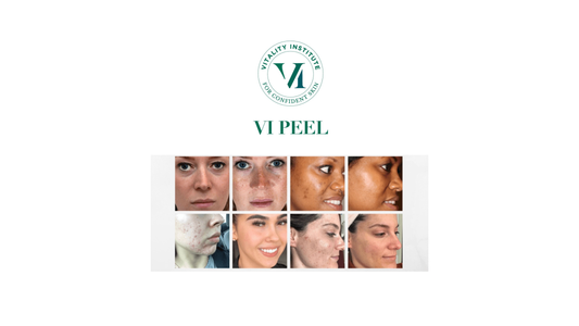 Understanding the Differences Between All the VI Peels