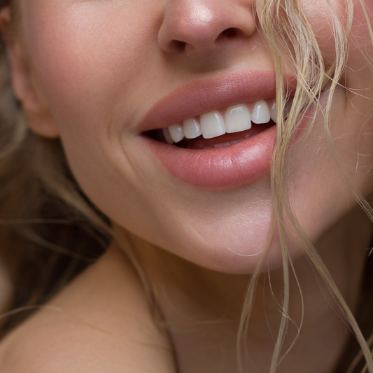 National Lipstick Day Event – Lip Filler Deposit (July 29)